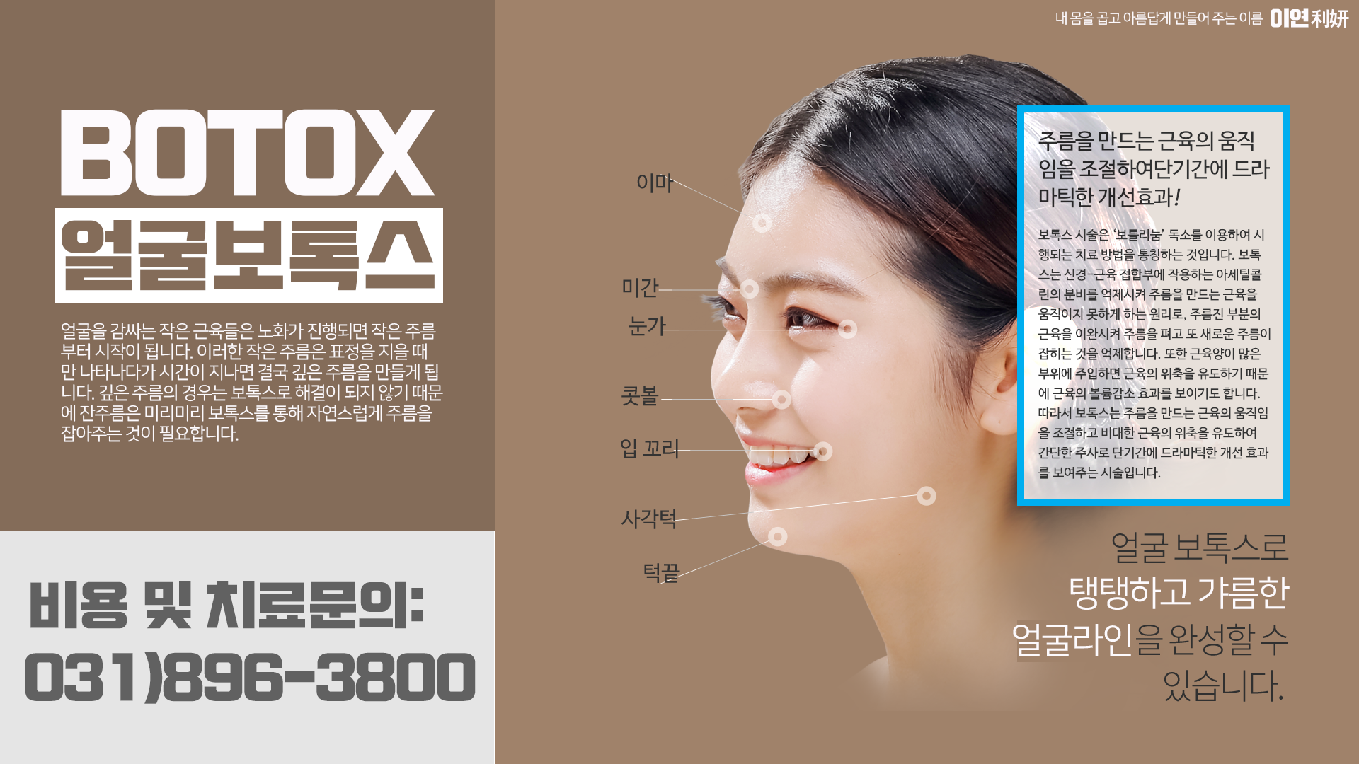 얼굴 주름 보톡스